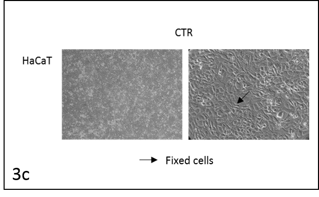 Picture 5: HaCaT CTR (4x and 20x magnification)